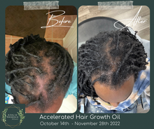 Load image into Gallery viewer, Accelerated Hair Growth Oil